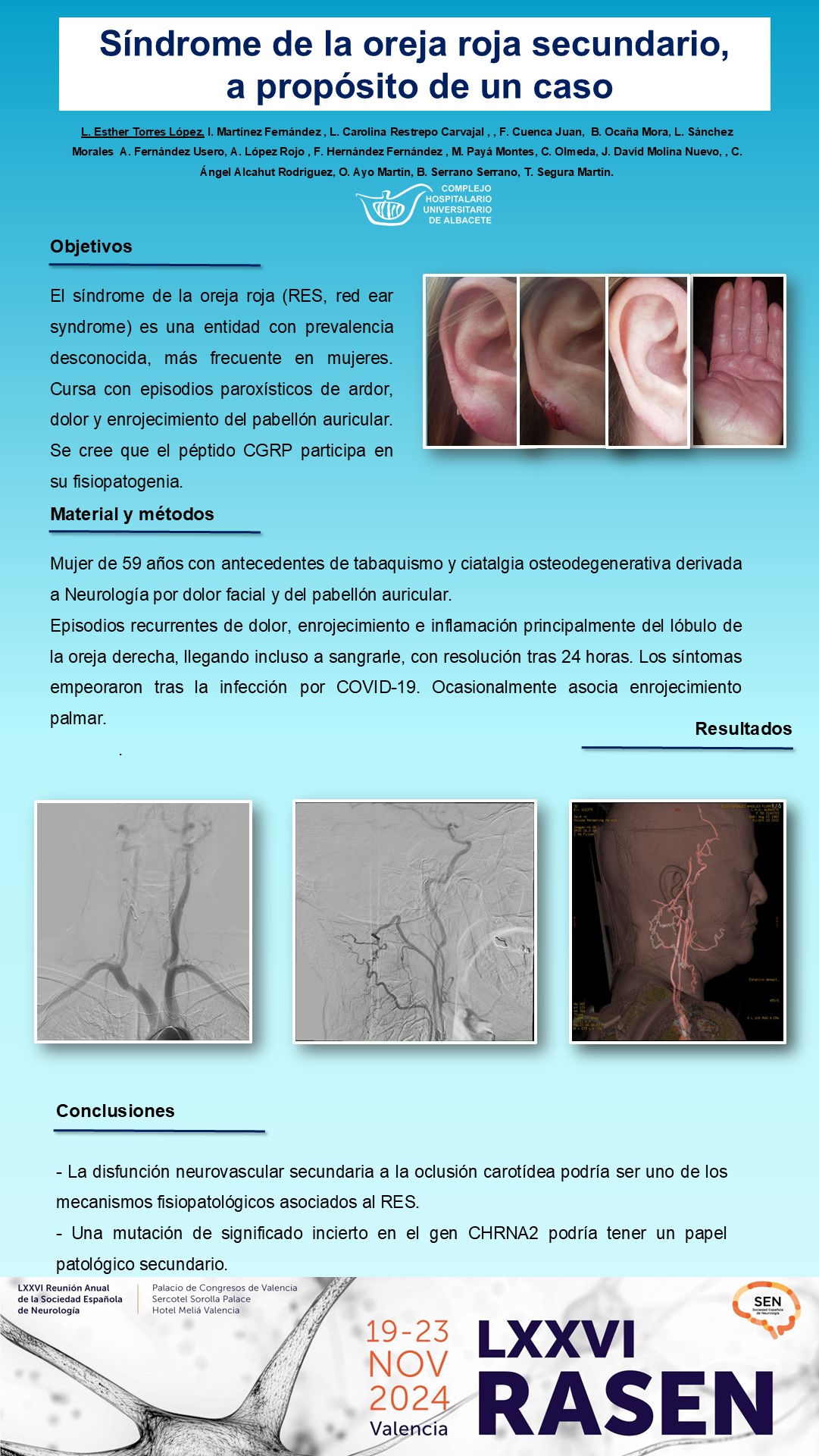 Síndrome de la oreja roja secundario, a propósito de un caso