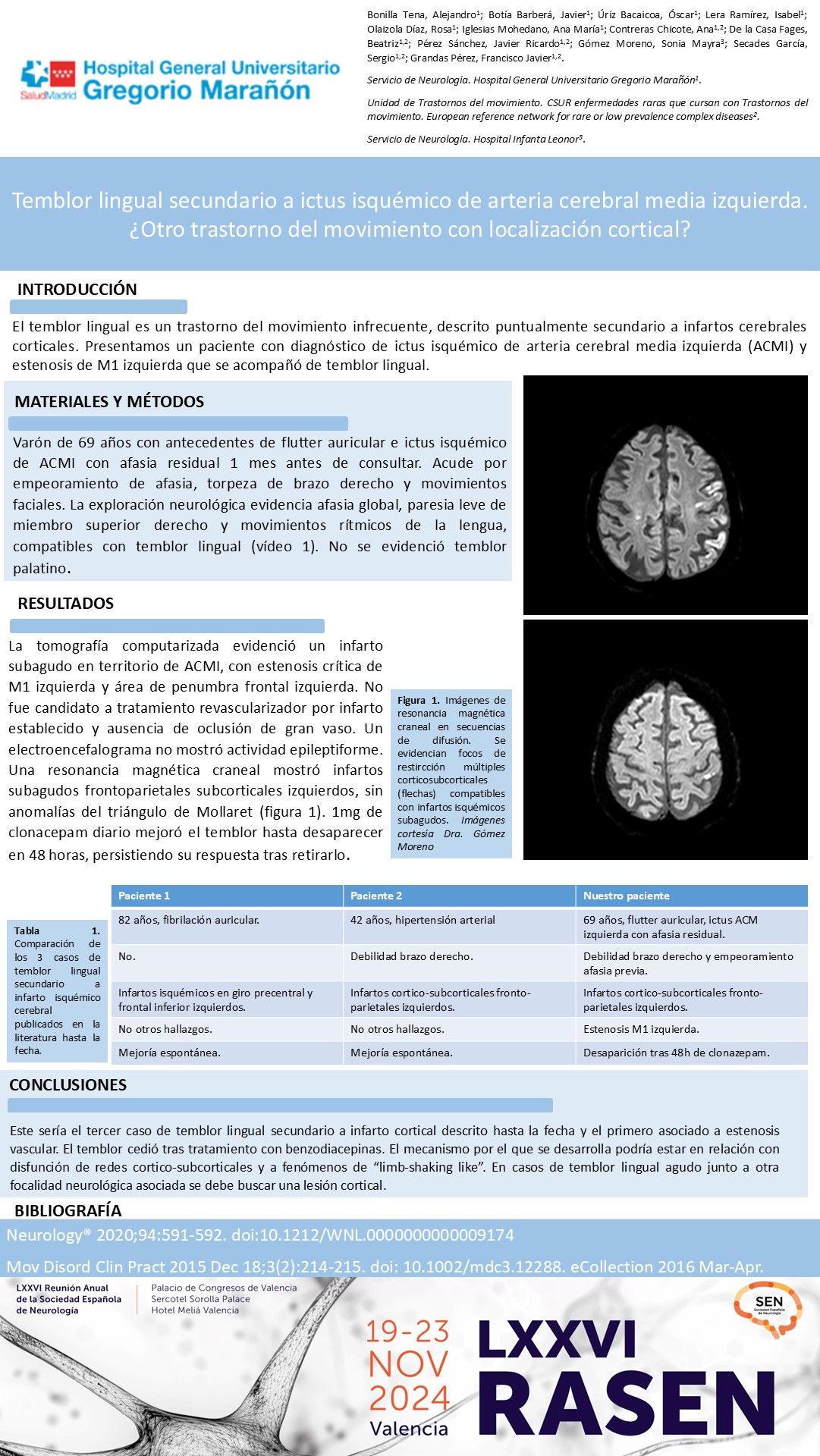 Temblor lingual secundario a ictus isquémico de arteria cerebral media izquierda. ¿Otro trastorno del movimiento con localización cortical?