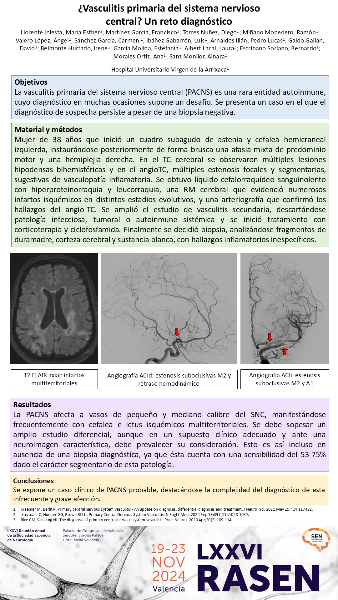¿Vasculitis primaria del sistema nervioso central? Un reto diagnóstico
