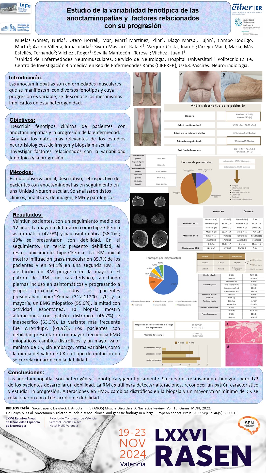 Estudio de la variabilidad fenotípica de las anoctaminopatias y factores relacionados con su progresión