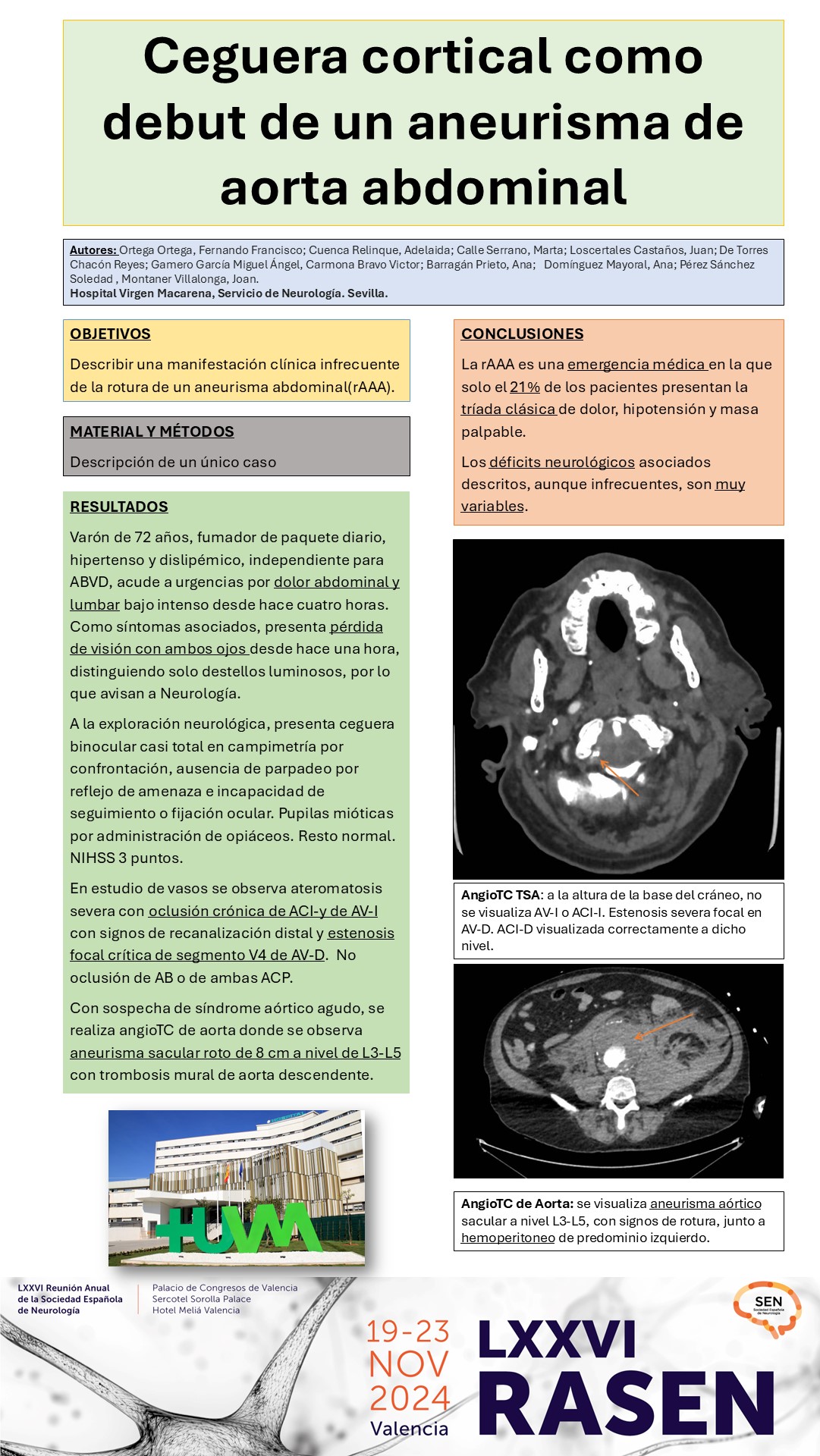 Ceguera cortical como debut de un aneurisma de aorta abdominal