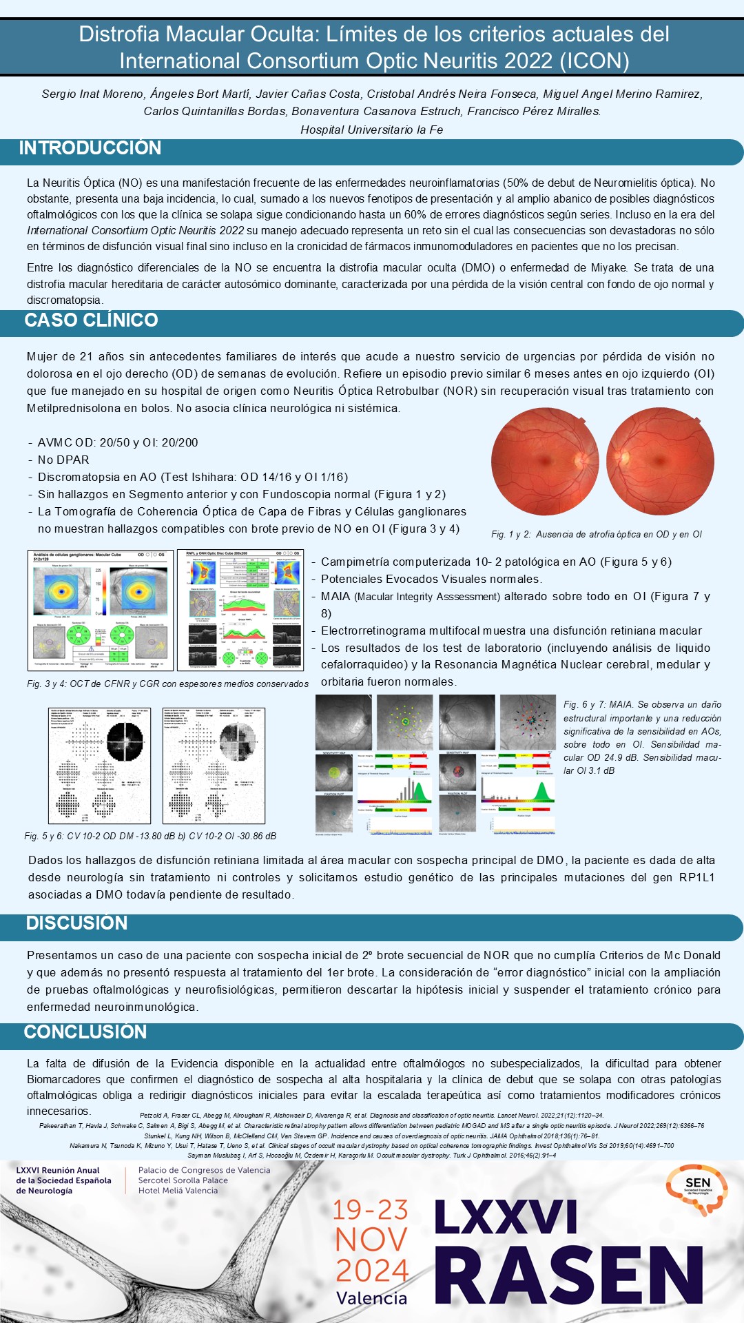 Distrofia Macular Oculta: Límites de los criterios actuales del International Consortium Optic Neuritis 2022 (ICON)