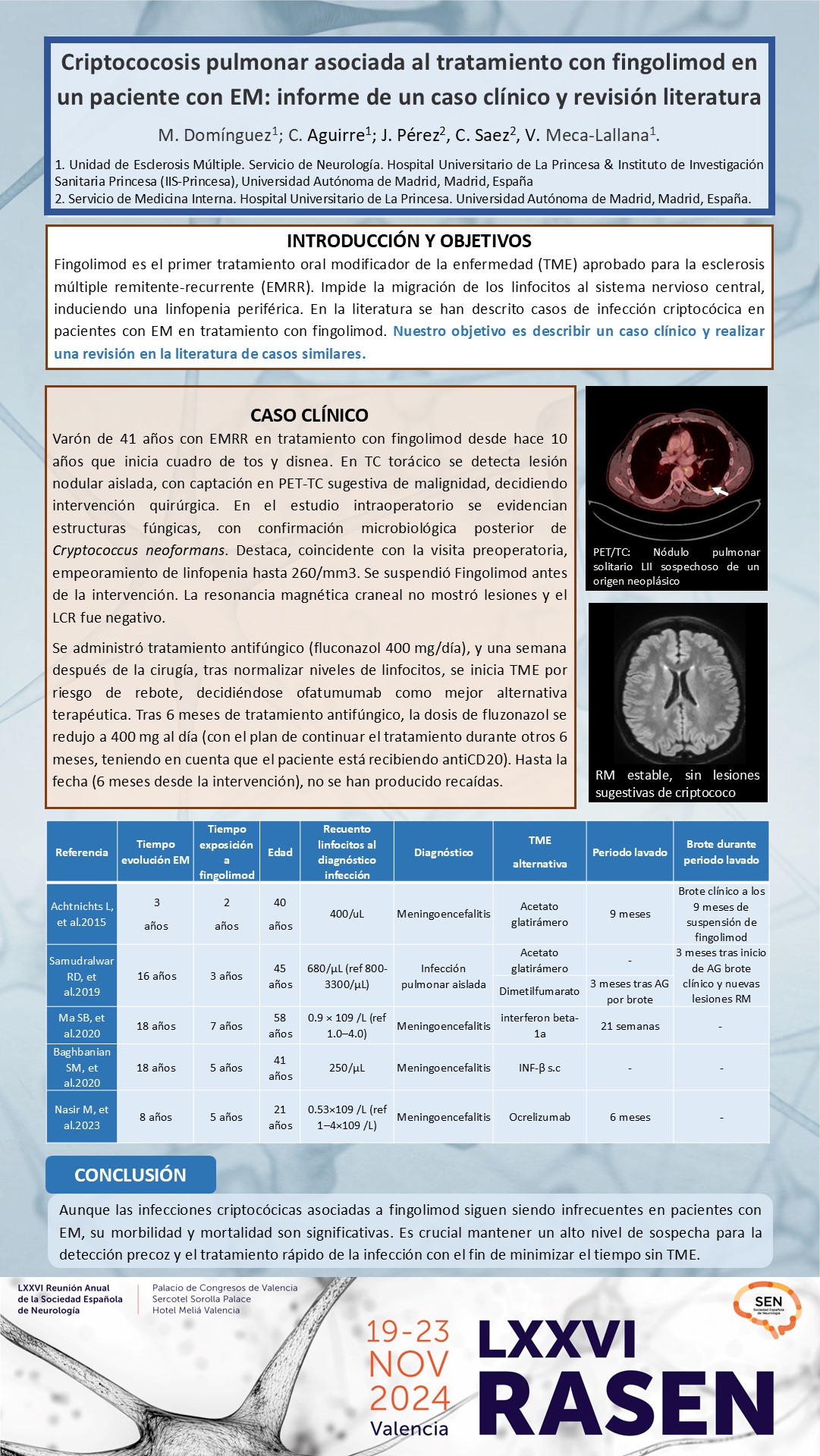 Criptococosis pulmonar asociada al tratamiento con fingolimod en un paciente con EM: informe de un caso clínico y revisión de la literatura