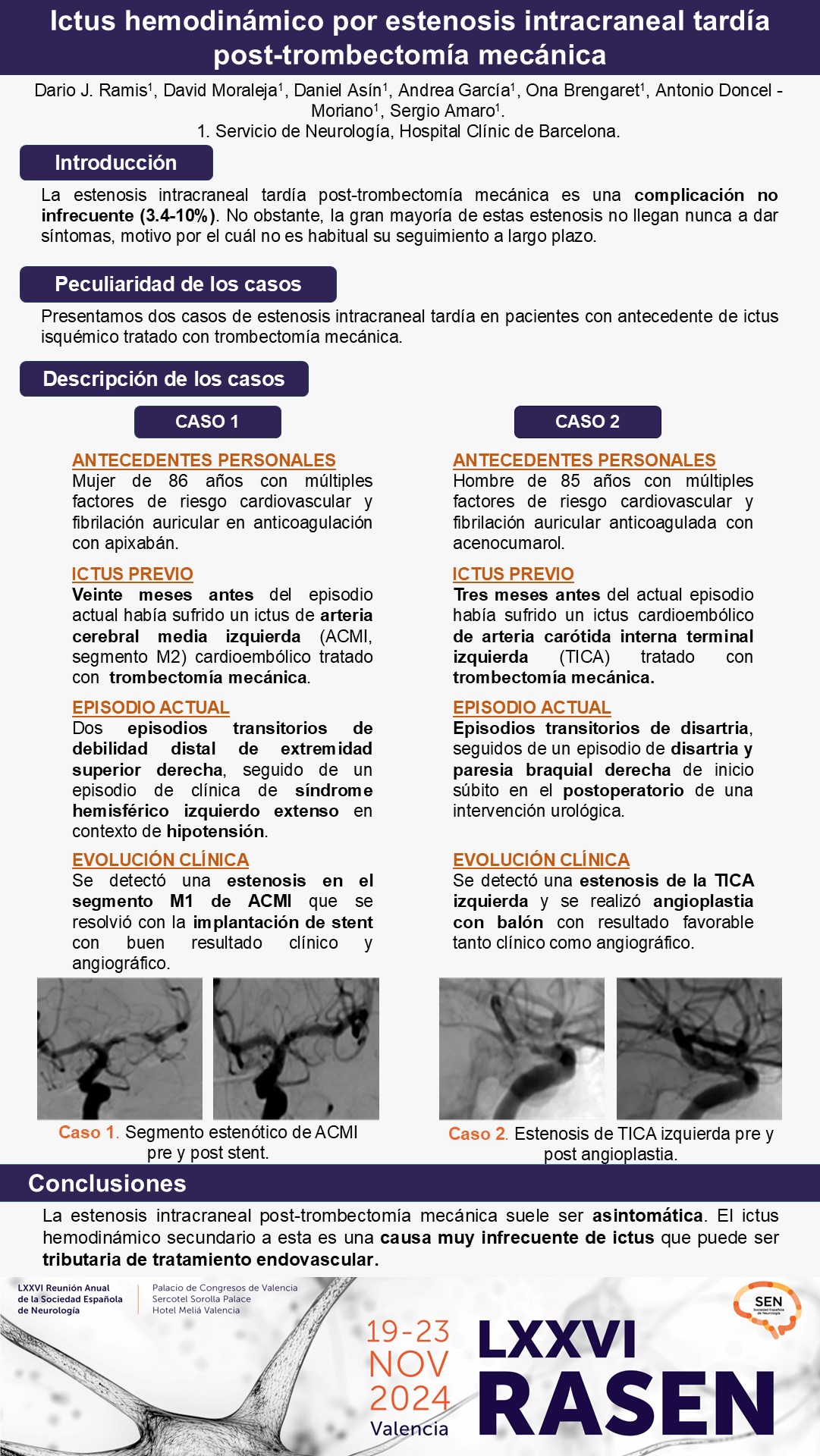 Ictus hemodinámico por estenosis intracraneal tardía post-trombectomía mecánica