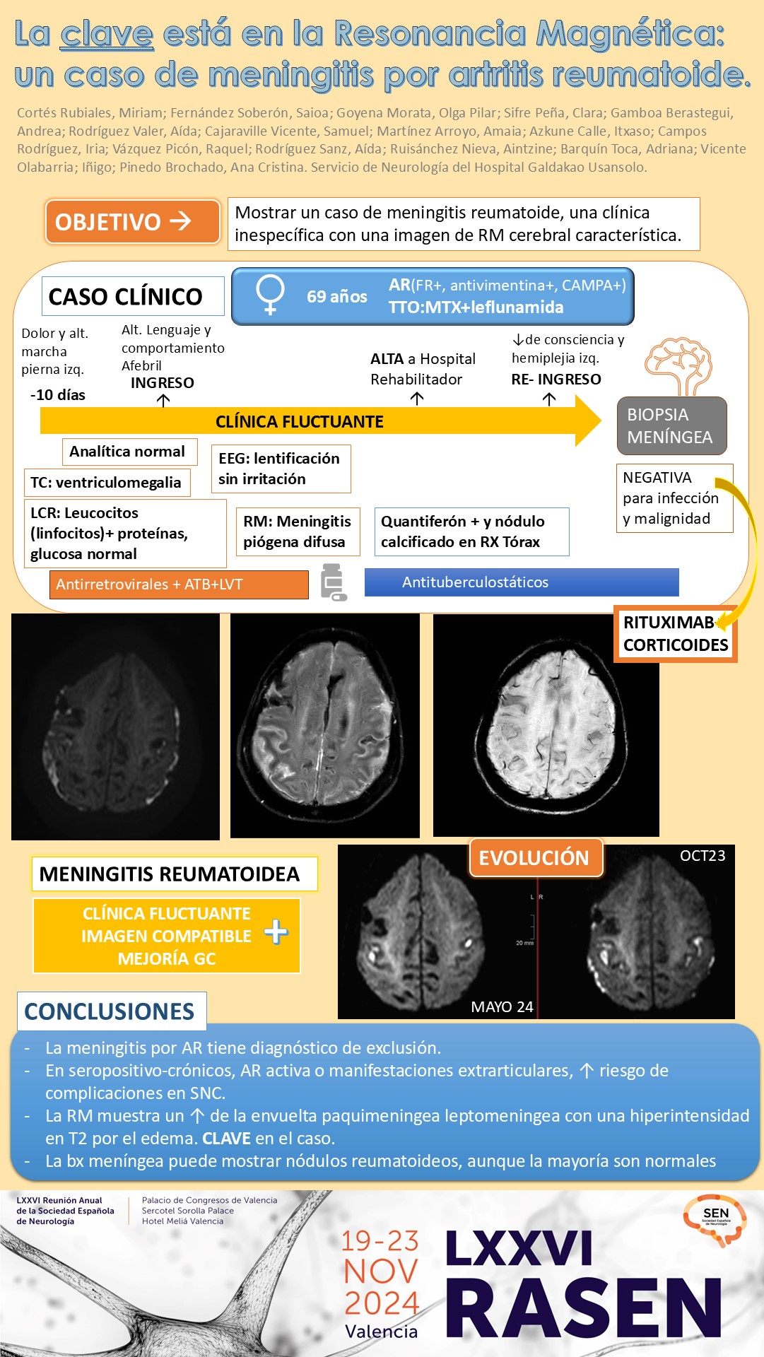La clave está en la resonancia magnética: un caso de meningitis por artritis reumatoide