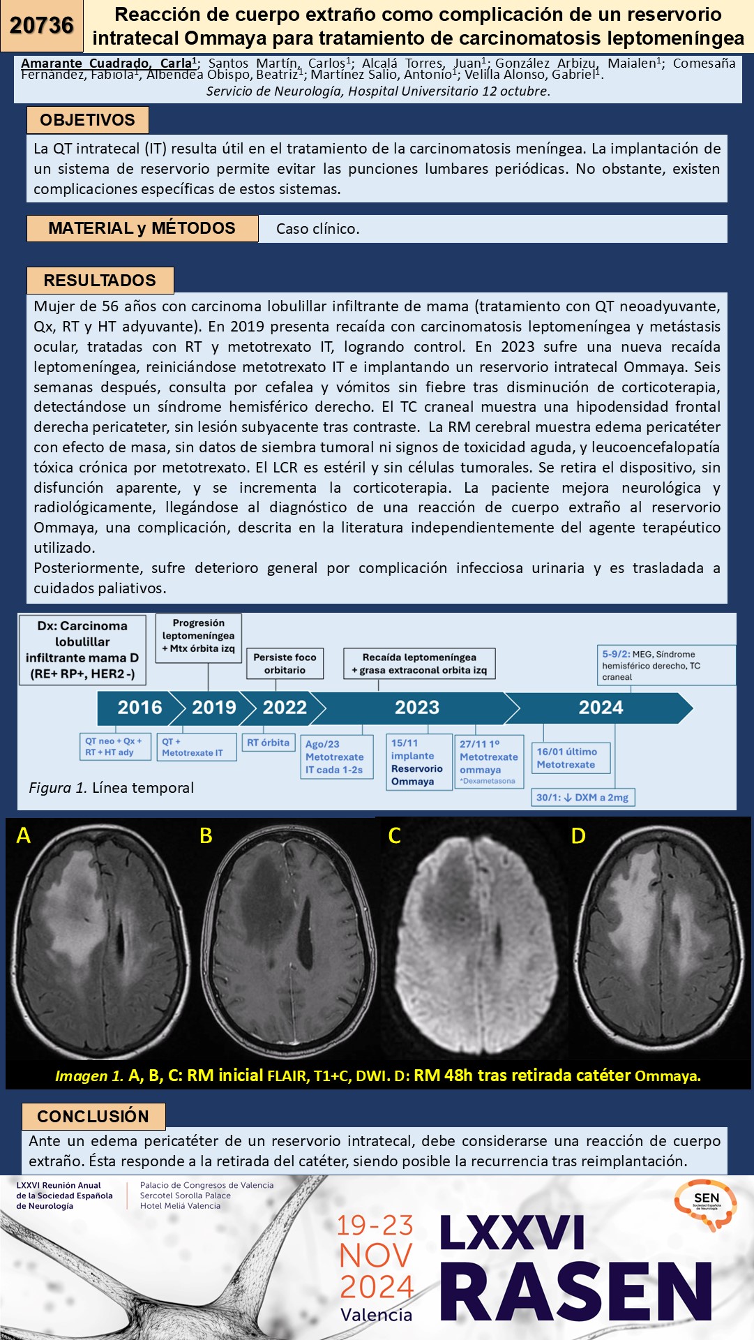 Reacción de cuerpo extraño como complicación de un reservorio intratecal Ommaya para tratamiento de carcinomatosis leptomeníngea