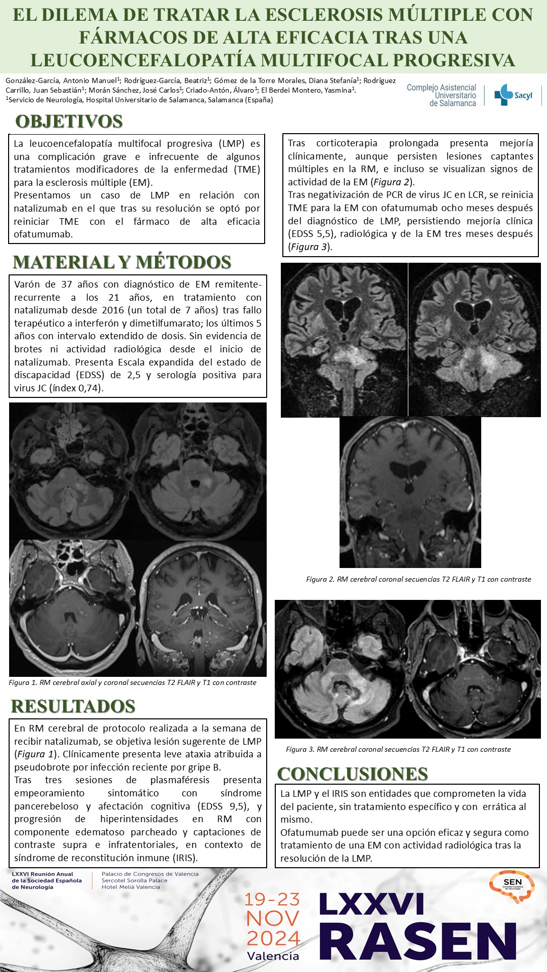 El dilema de tratar la esclerosis múltiple con fármacos de alta eficacia tras una leucoencefalopatía multifocal progresiva