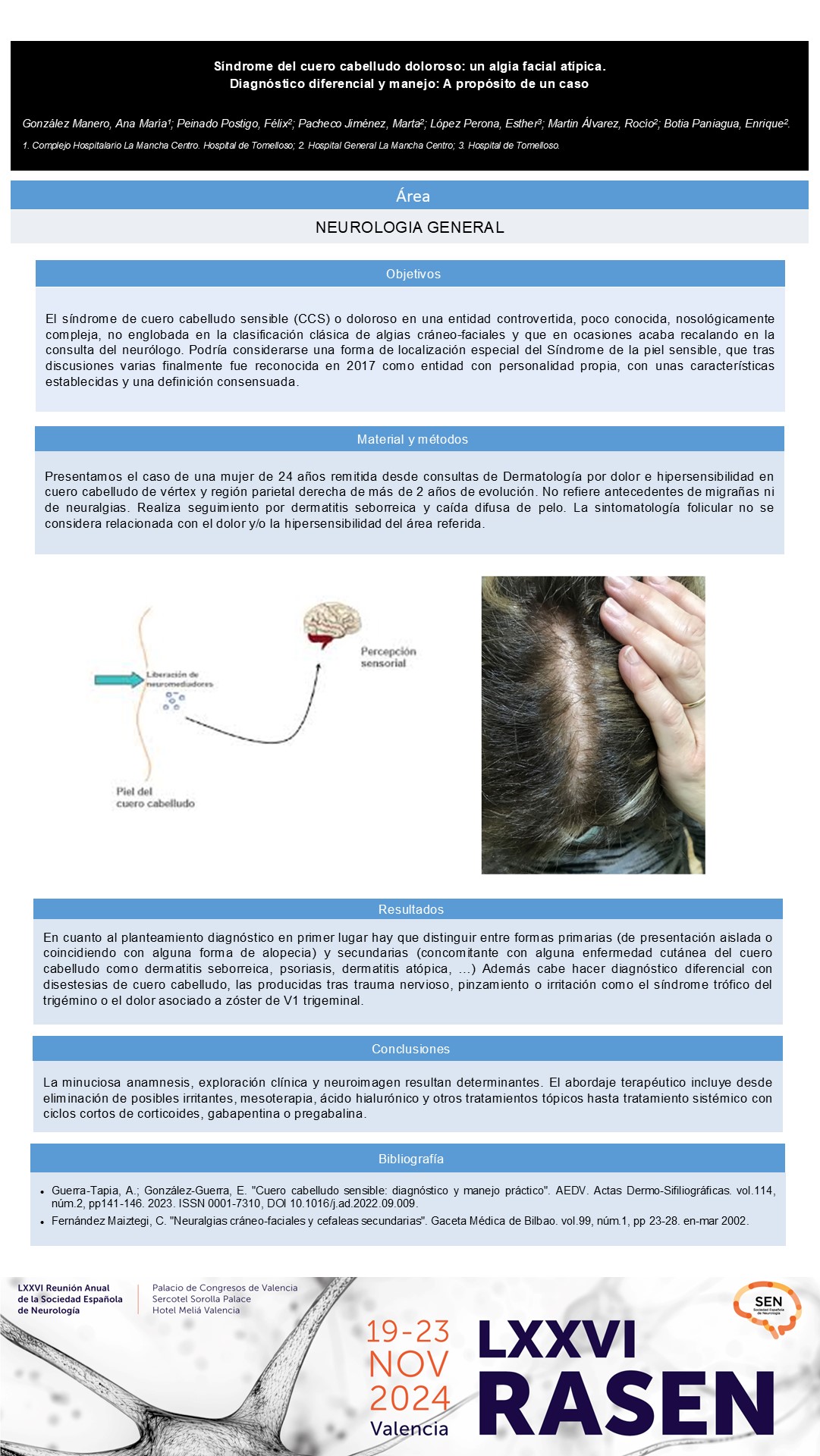 Síndrome del cuero cabelludo doloroso: un algia facial atípica. Diagnóstico diferencial y manejo: A propósito de un caso 