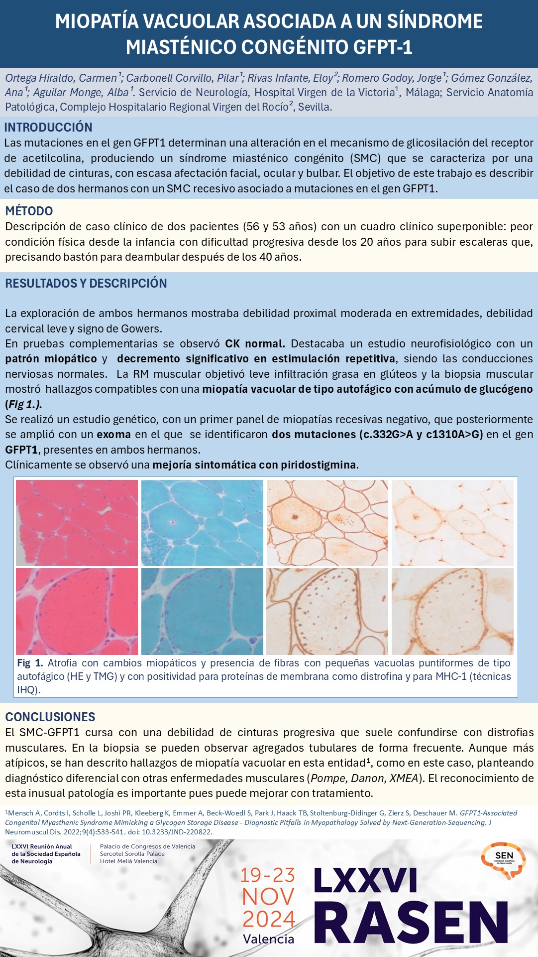 Miopatía vacuolar asociada a un síndrome miasténico congénito-GFPT1