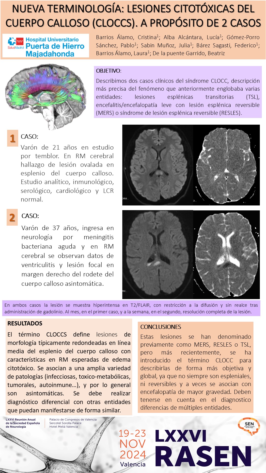 Nueva terminología: Lesiones citotóxicas del cuerpo calloso (CLOCCS). A propósito de 2 casos