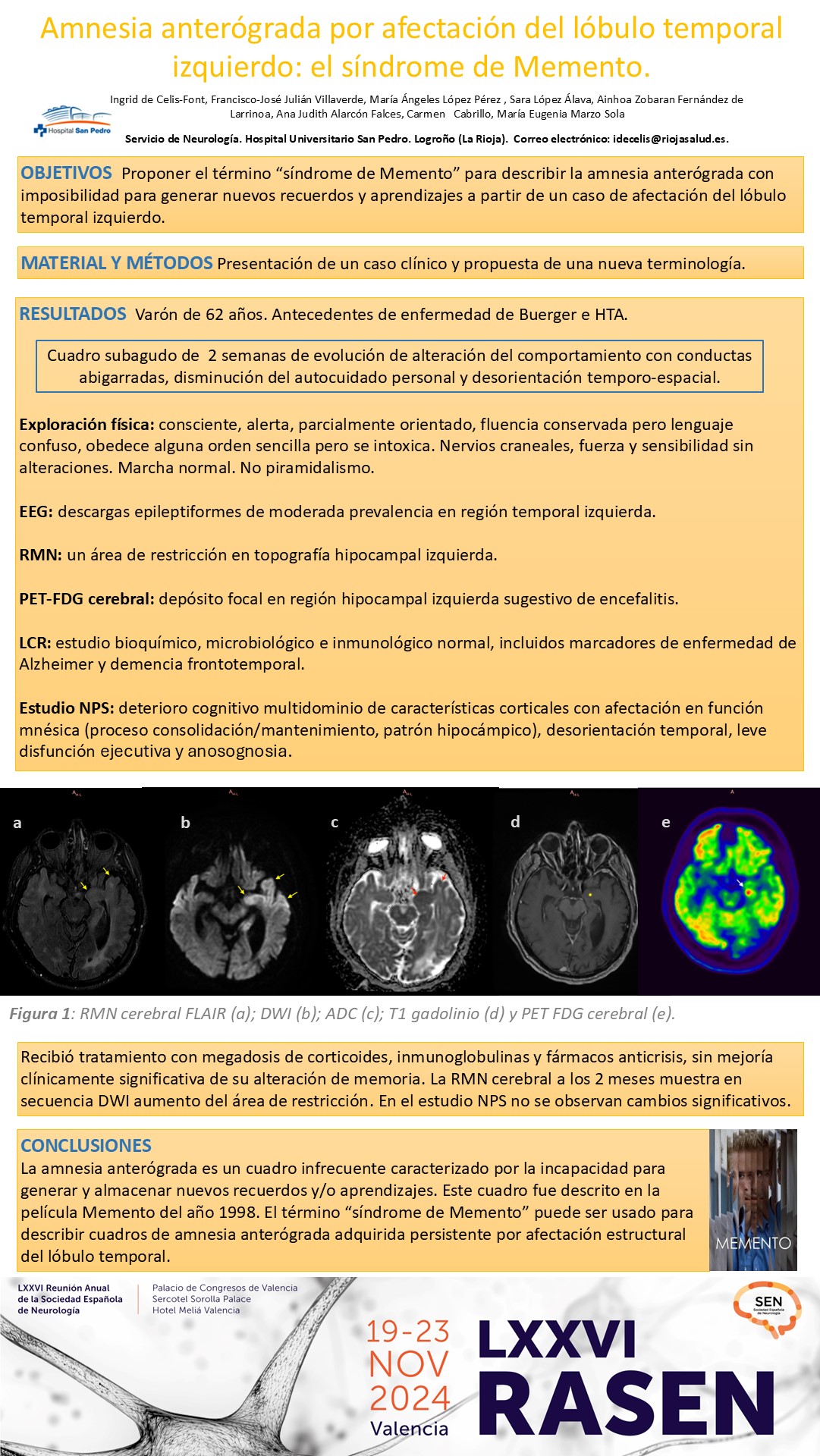 Amnesia anterógrada por afectación del lóbulo temporal izquierdo: el síndrome de Memento