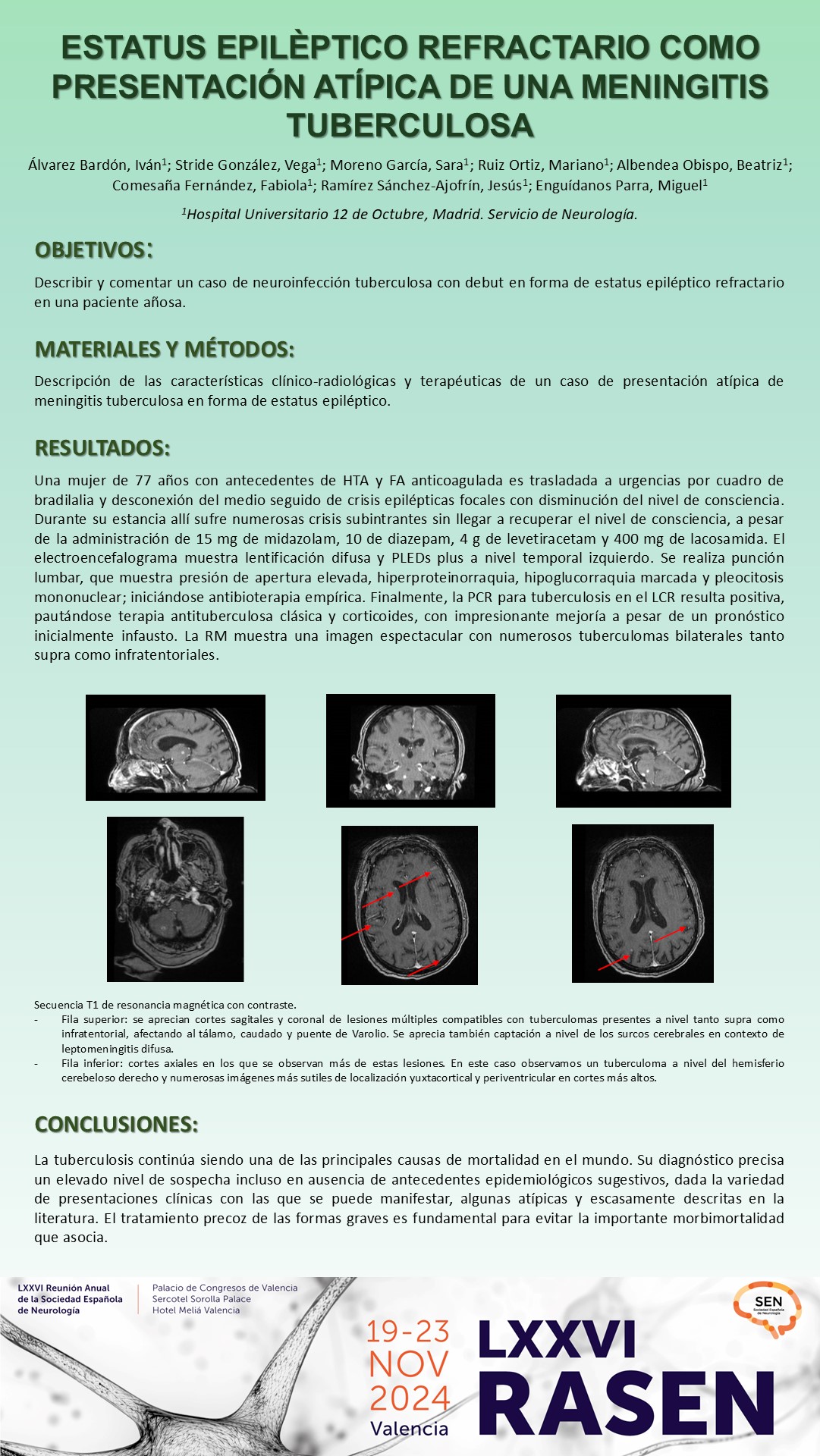 Estatus epiléptico refractario como presentación atípica de una meningitis tuberculosa