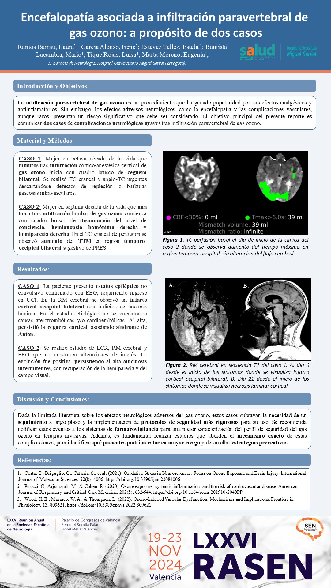 Encefalopatía asociada a infiltración paravertebral de gas ozono: a propósito de dos casos