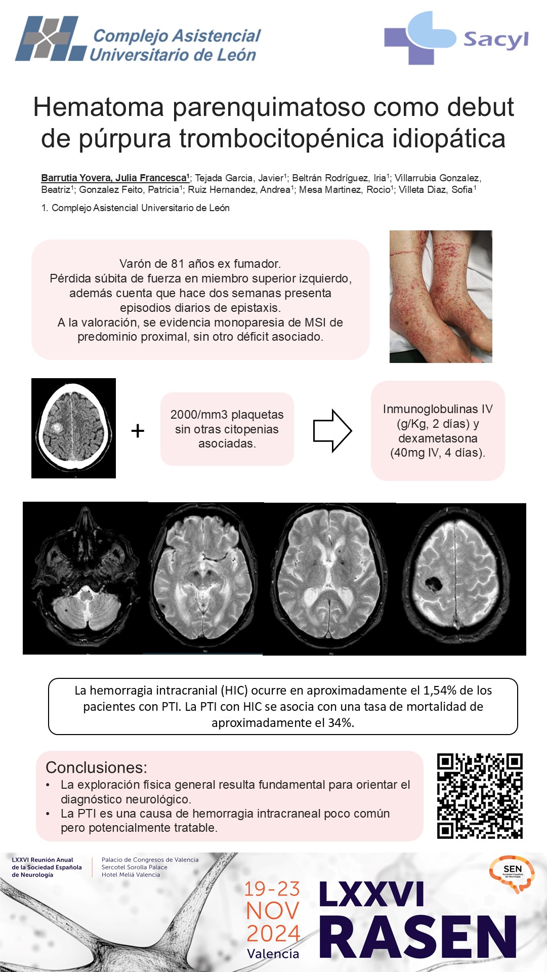 Hematoma parenquimatoso como debut de púrpura trombocitopénica idiopática