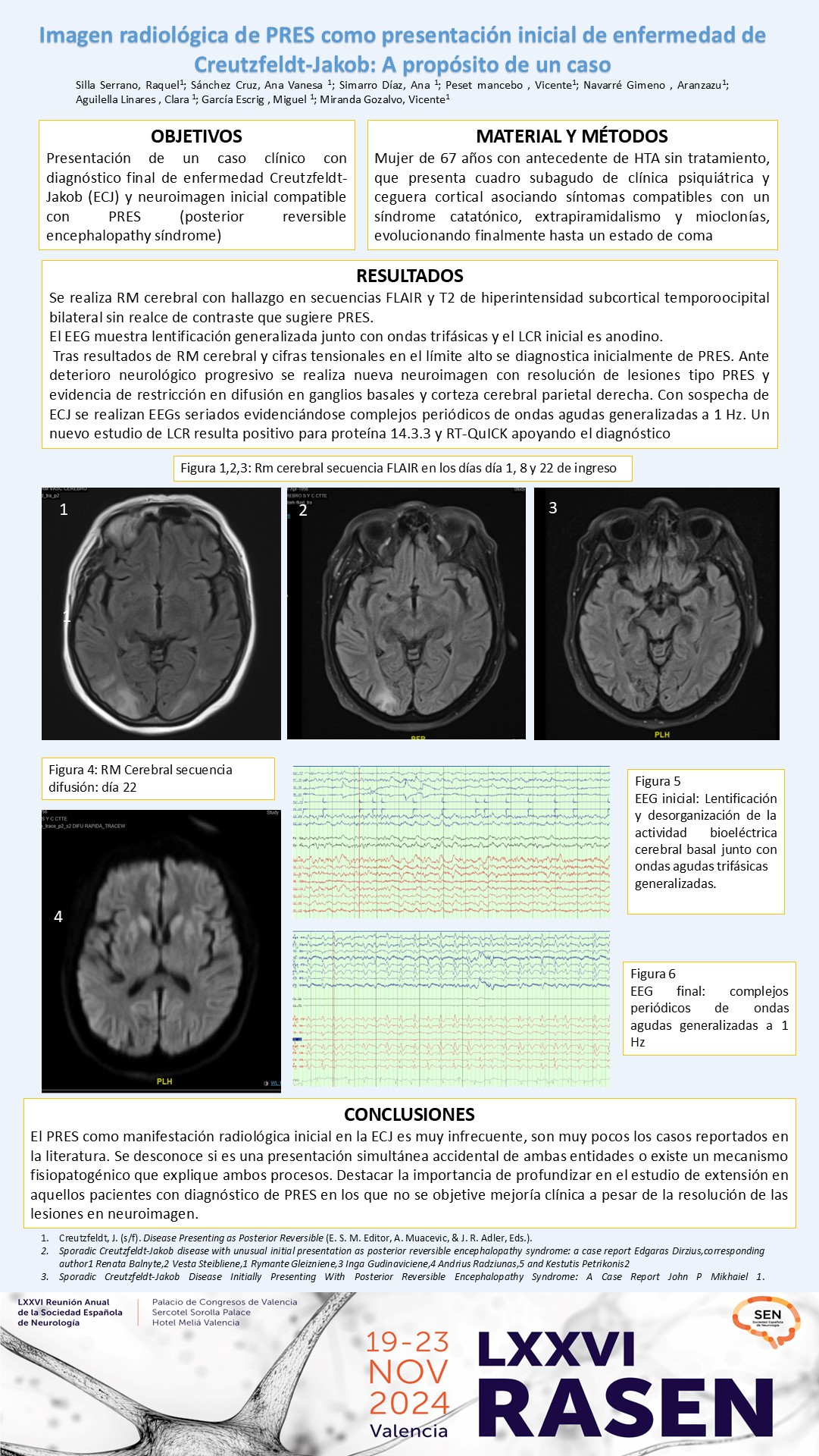 Imagen radiológica de PRES como presentación inicial de enfermedad de Creutzfeldt-Jakob: A propósito de un caso