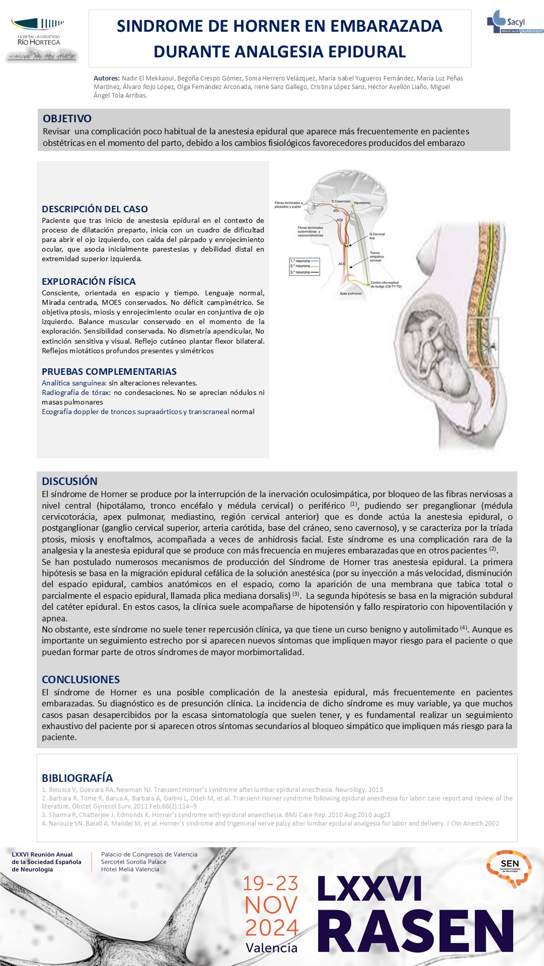 Síndrome de Horner en embarazada durante analgesia epidural