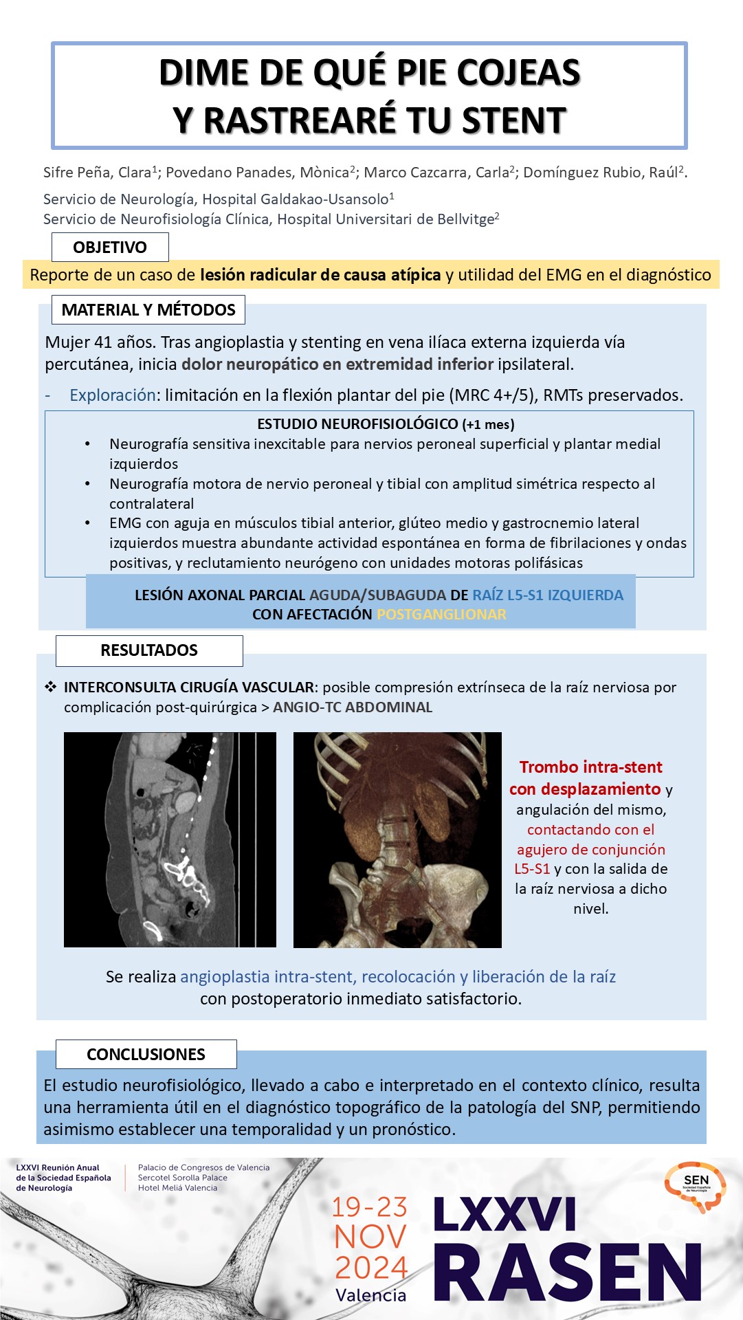 Dime de qué pie cojeas y rastrearé tu stent