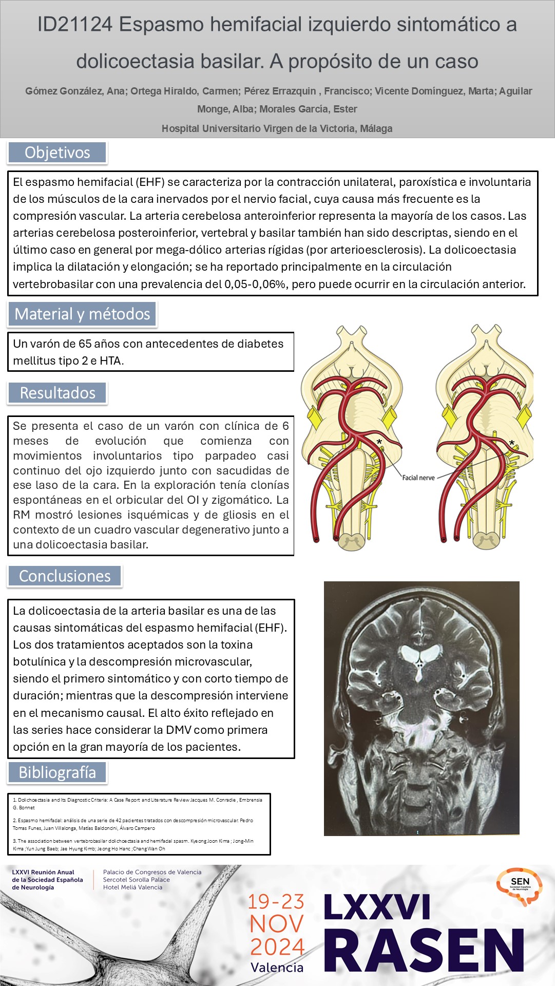 Espasmo hemifacial izquierdo sintomático a dolicoectasia basilar. A propósito de un caso