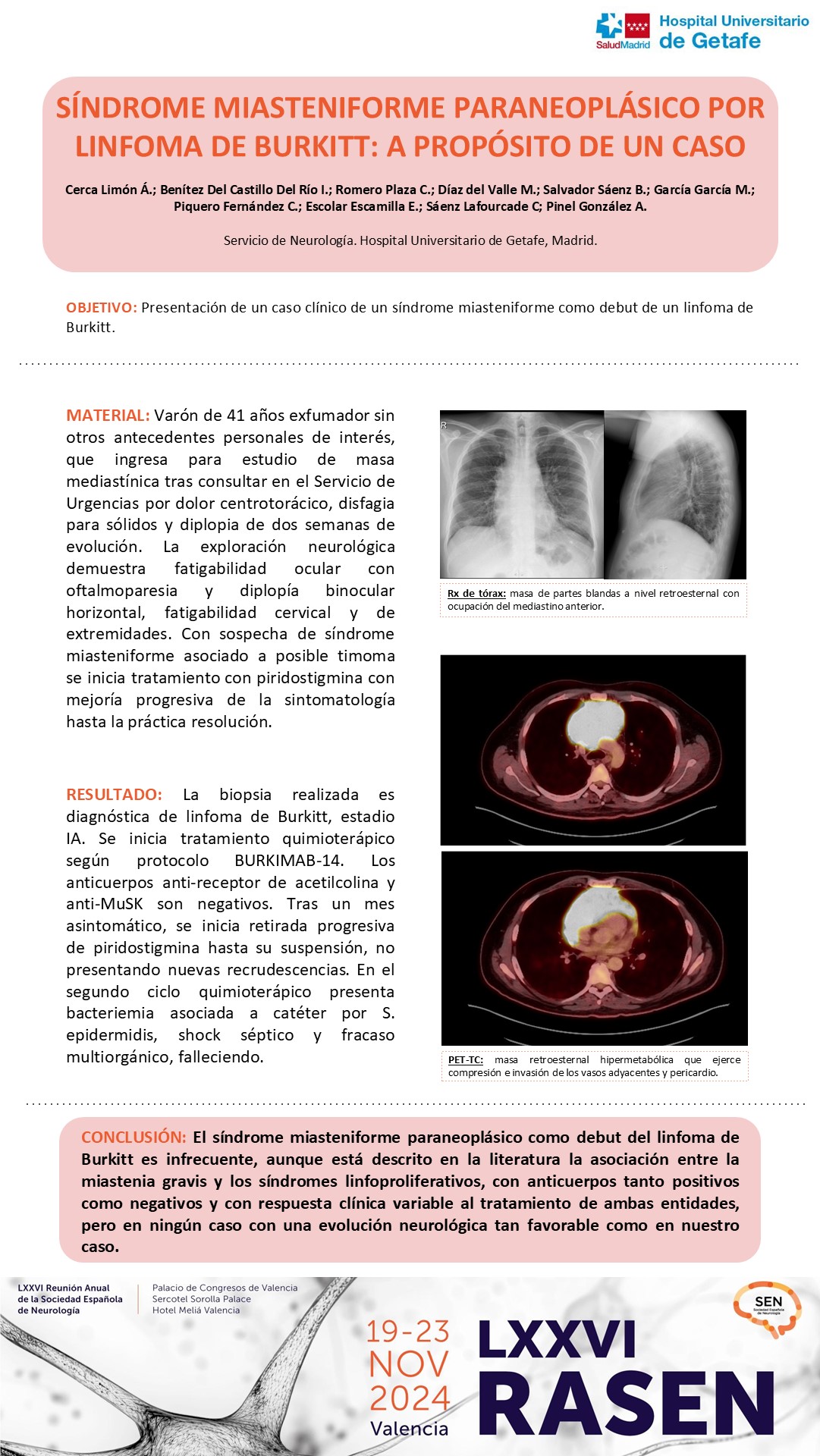 Síndrome miasteniforme paraneoplásico por linfoma de Burkitt: A propósito de un caso