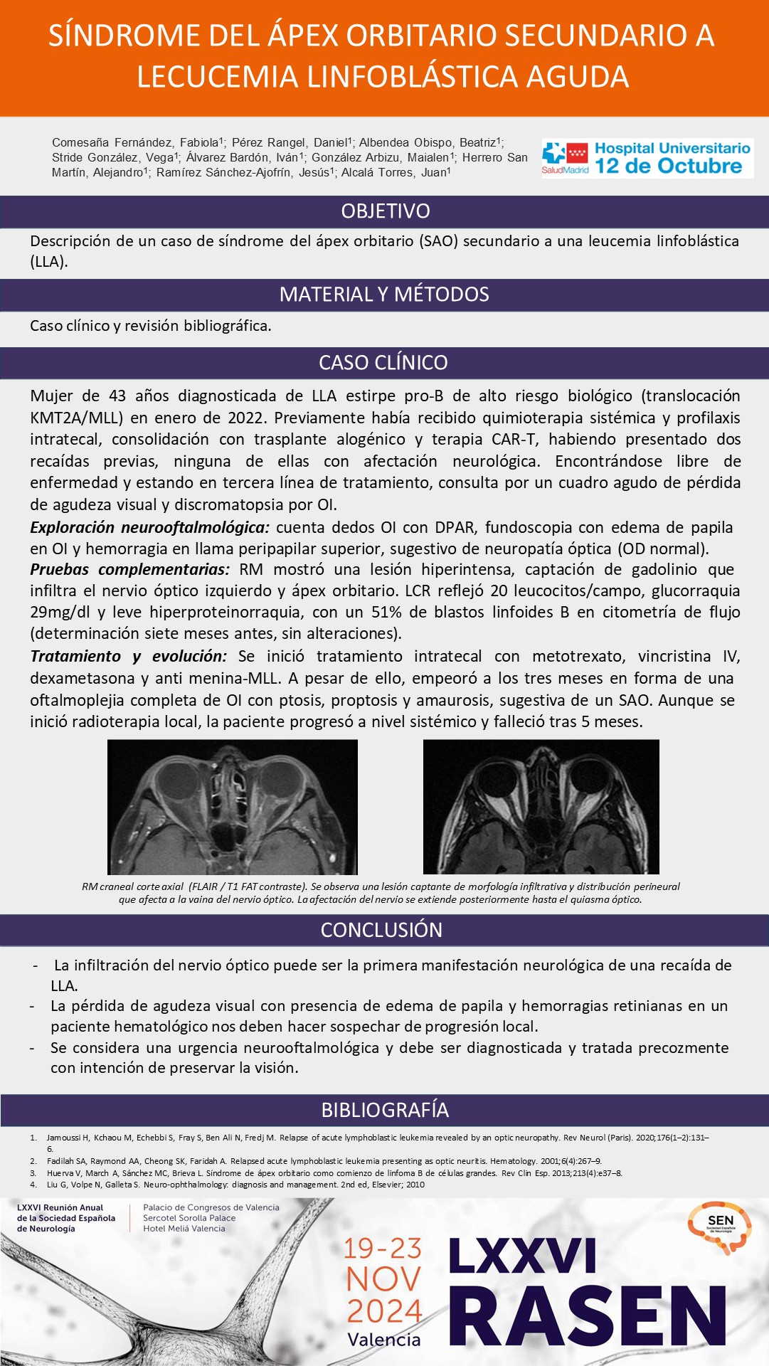Síndrome del ápex orbitario secundario a leucemia linfoblástica aguda