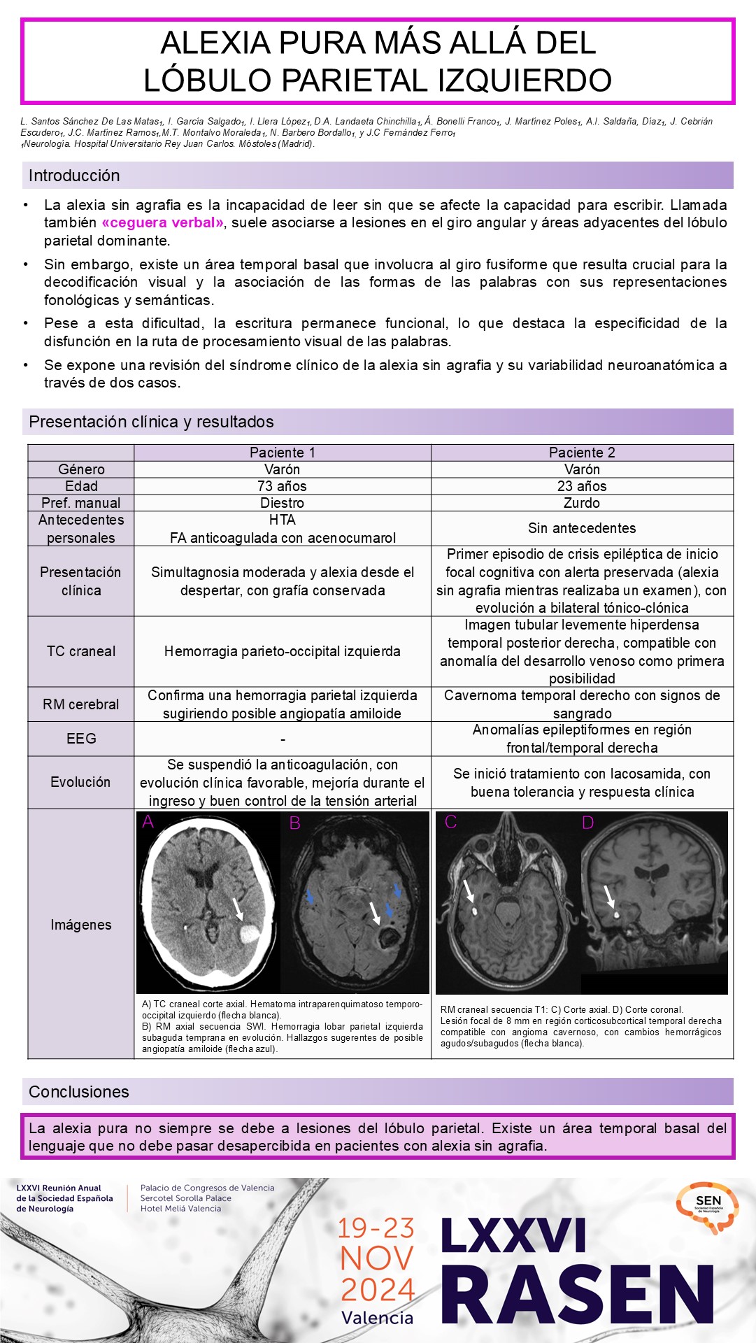 Alexia pura más allá del lóbulo parietal izquierdo
