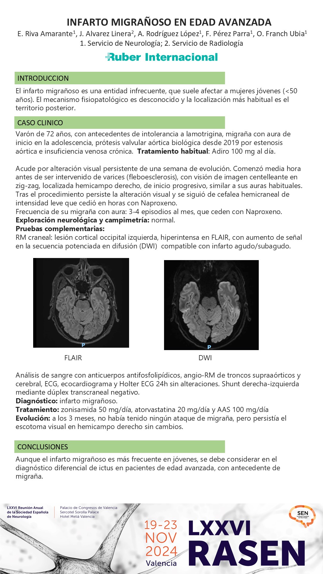 Infarto migrañoso en edad avanzada