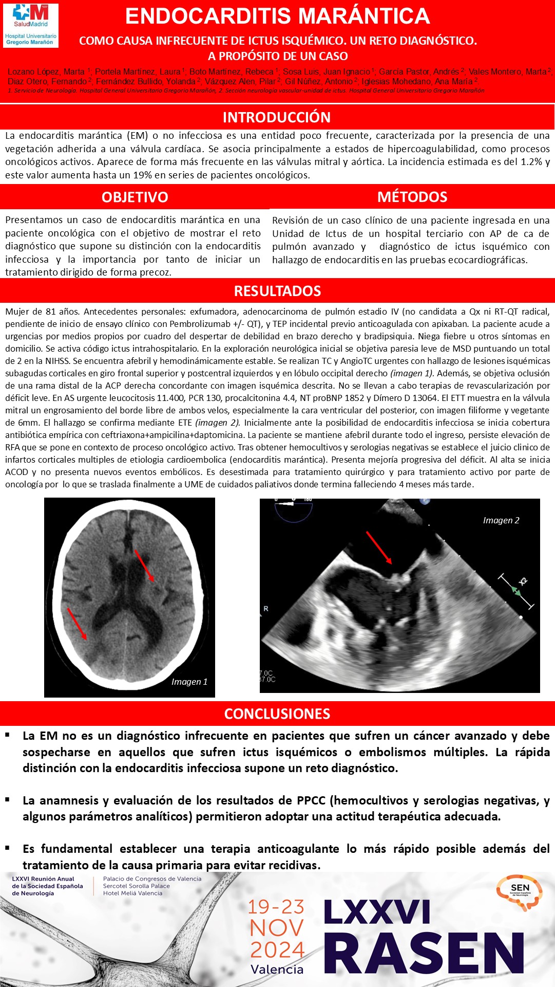 Endocarditis marántica como causa infrecuente de ictus isquémico. Un reto diagnóstico