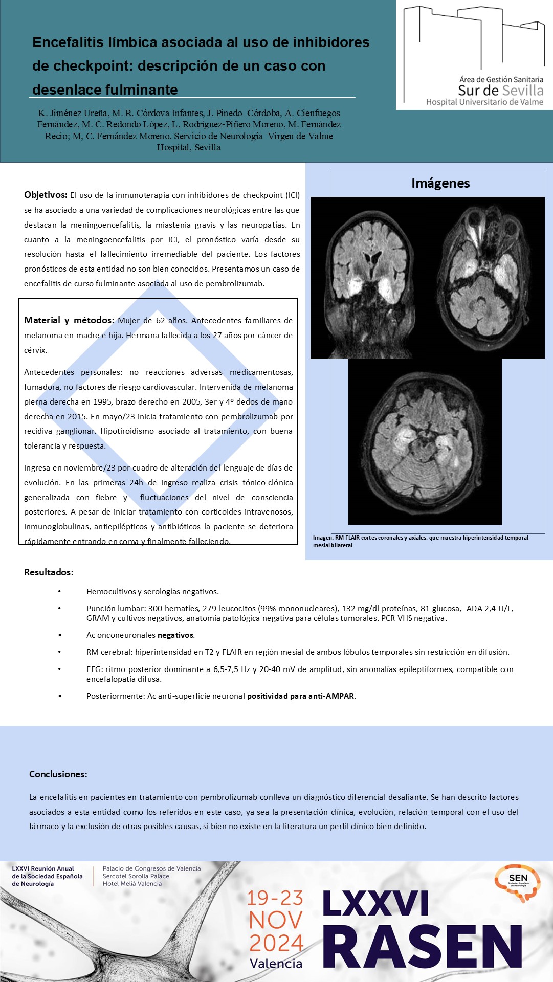 Encefalitis límbica asociada al uso de inhibidores de check-point: descripción de un caso con desenlace fulminante