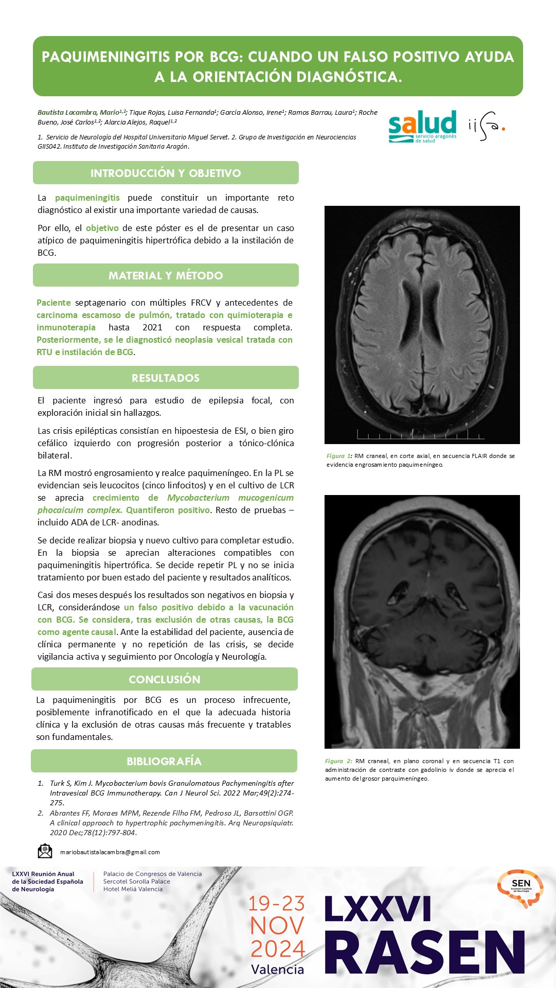 Paquimeningitis por BCG: cuando un falso positivo ayuda a la orientación diagnóstica