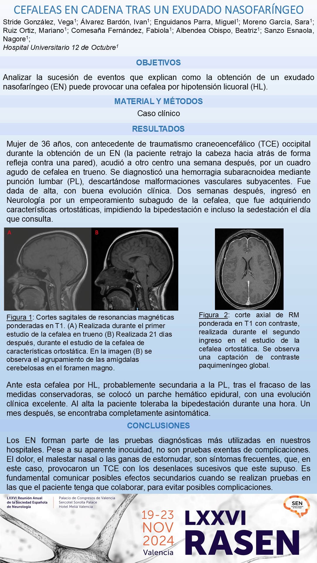 Cefaleas en cadena tras un exudado nasofaríngeo