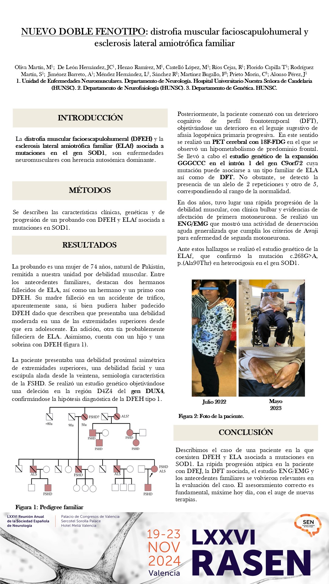 Nuevo doble fenotipo: distrofia muscular facioescapulohumeral y esclerosis lateral amiotrófica familiar 