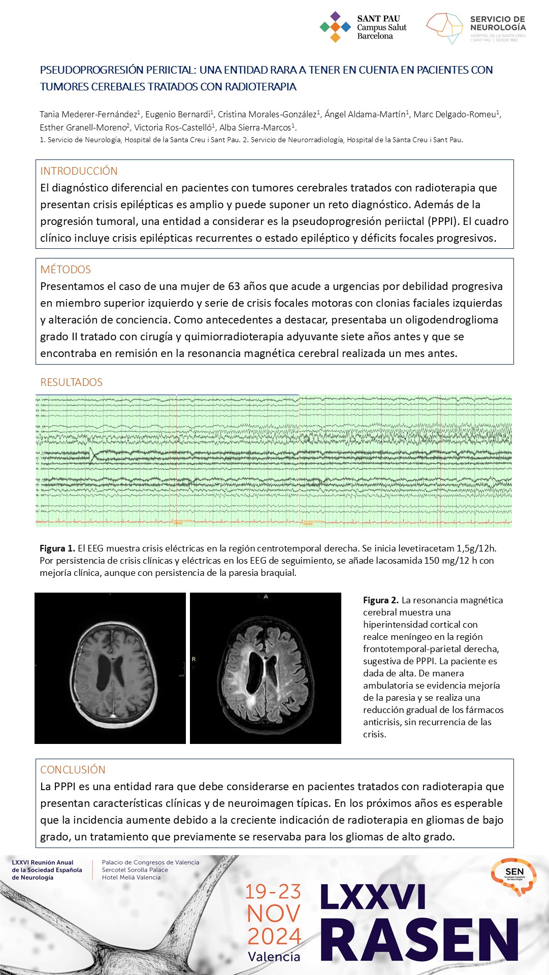 Pseudoprogresión periictal: una entidad rara a tener en cuenta en pacientes con tumores cerebrales tratados con radioterapia