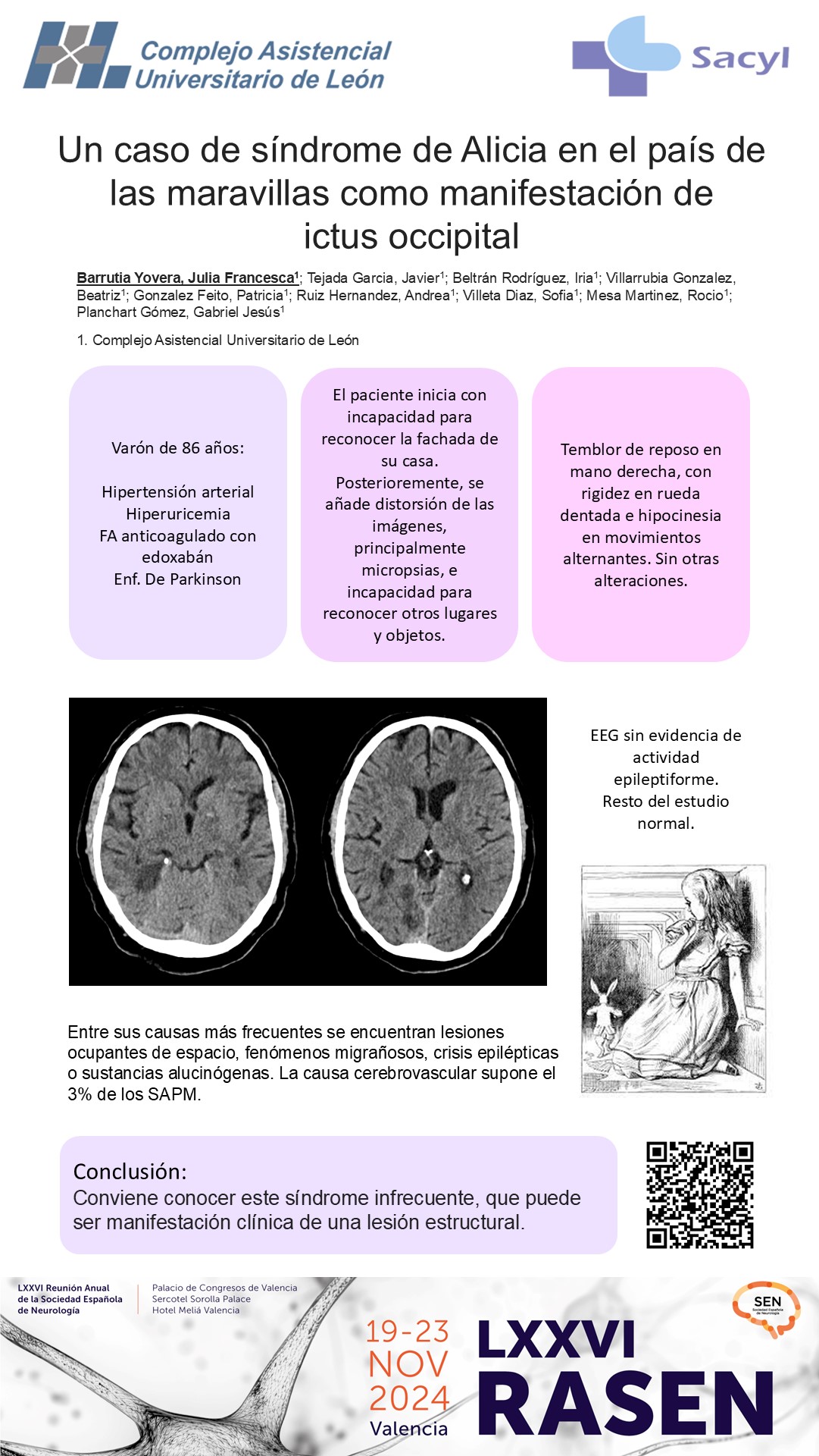 Un caso de síndrome de Alicia en el país de las maravillas como manifestación de ictus occipital