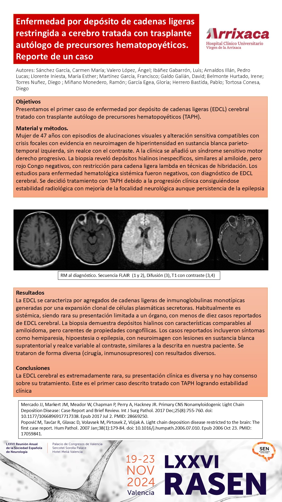 Enfermedad por depósito de cadenas ligeras restringida a cerebro tratada con trasplante autólogo de precursores hematopoyéticos. Reporte de un caso