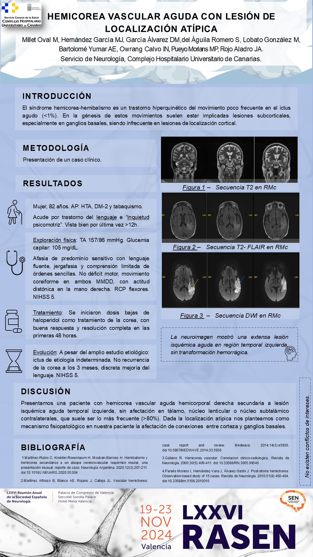 Hemicorea vascular aguda con lesión de localización atípica