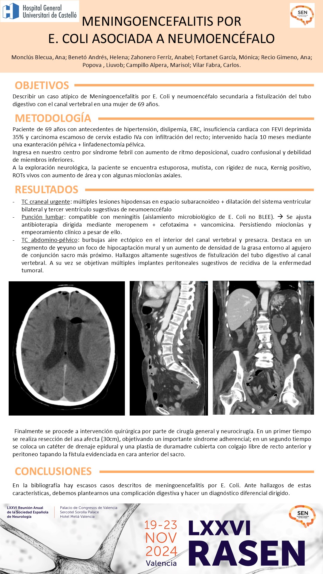 Meningoencefalitis por E. Coli asociada a neumoencéfalo
