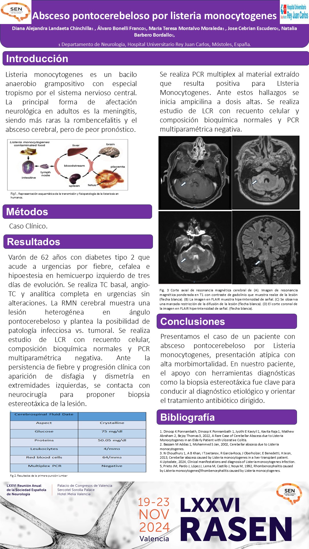Absceso pontocerebeloso secundario a  listeria monocytogenes