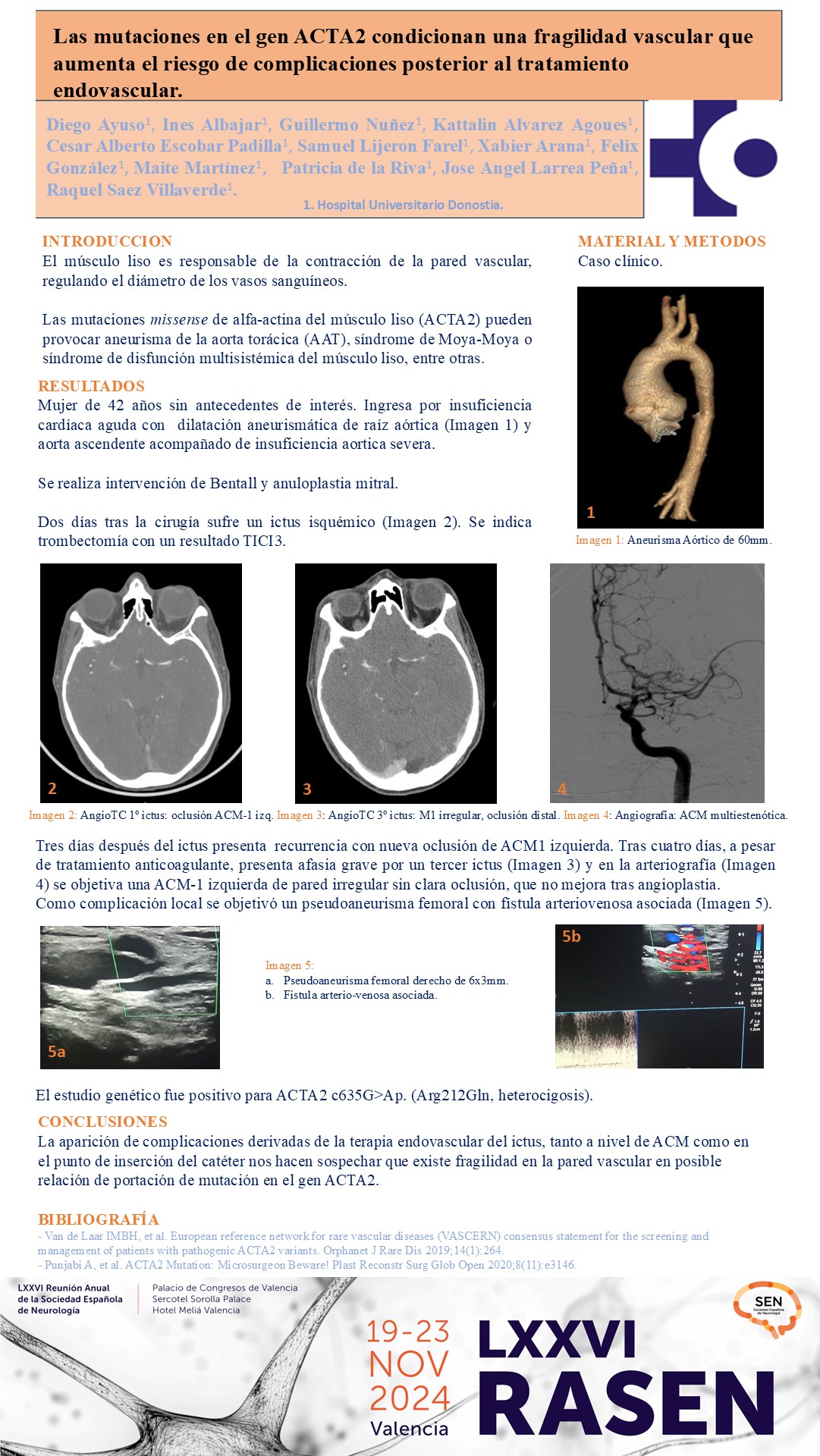 Las mutaciones en el gen ACTA2 condicionan una fragilidad vascular que aumenta el riesgo de complicaciones posterior al tratamiento endovascular