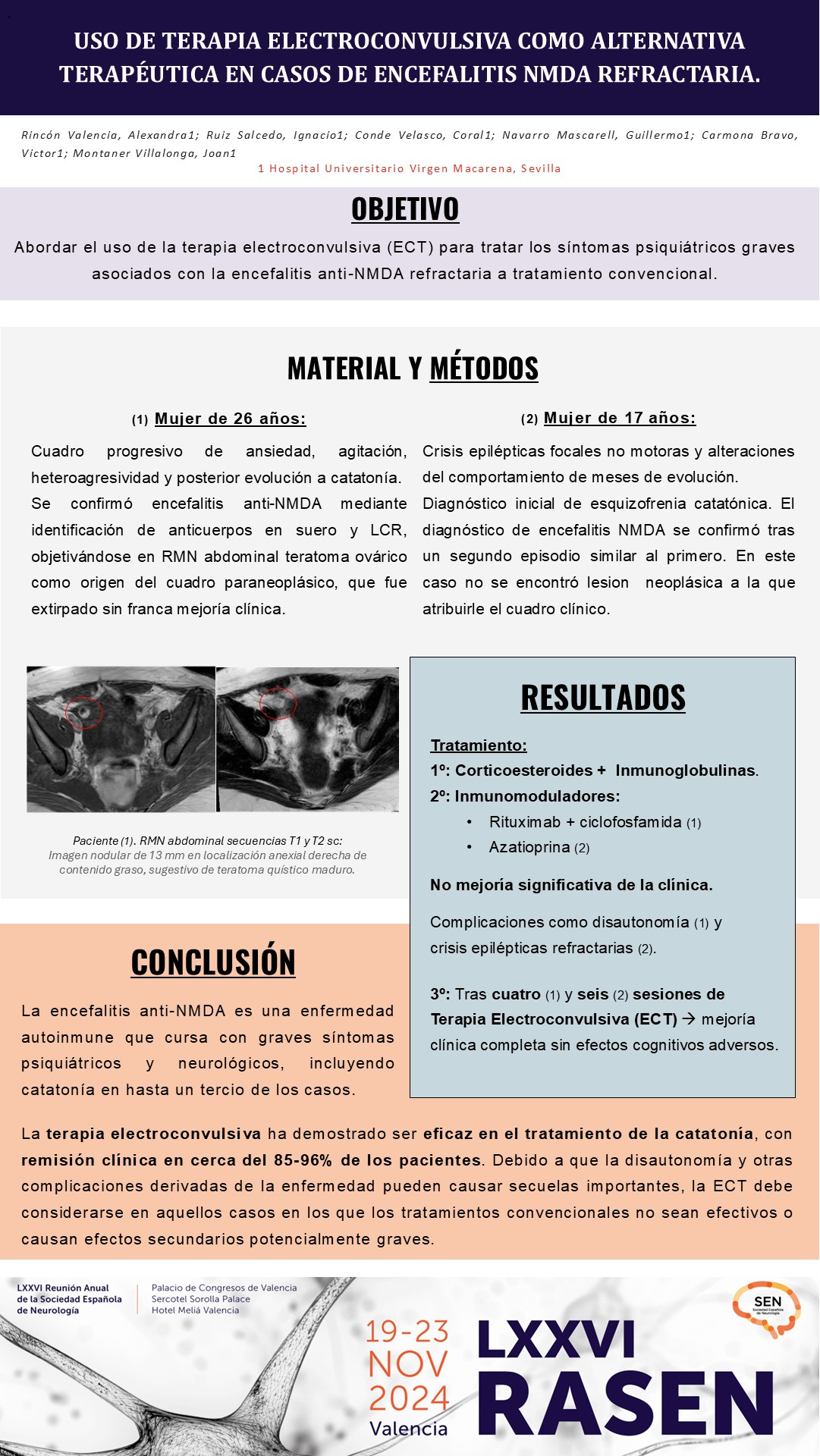 Uso de terapia electroconvulsiva como alternativa terapéutica en casos de encefalitis NMDA refractaria