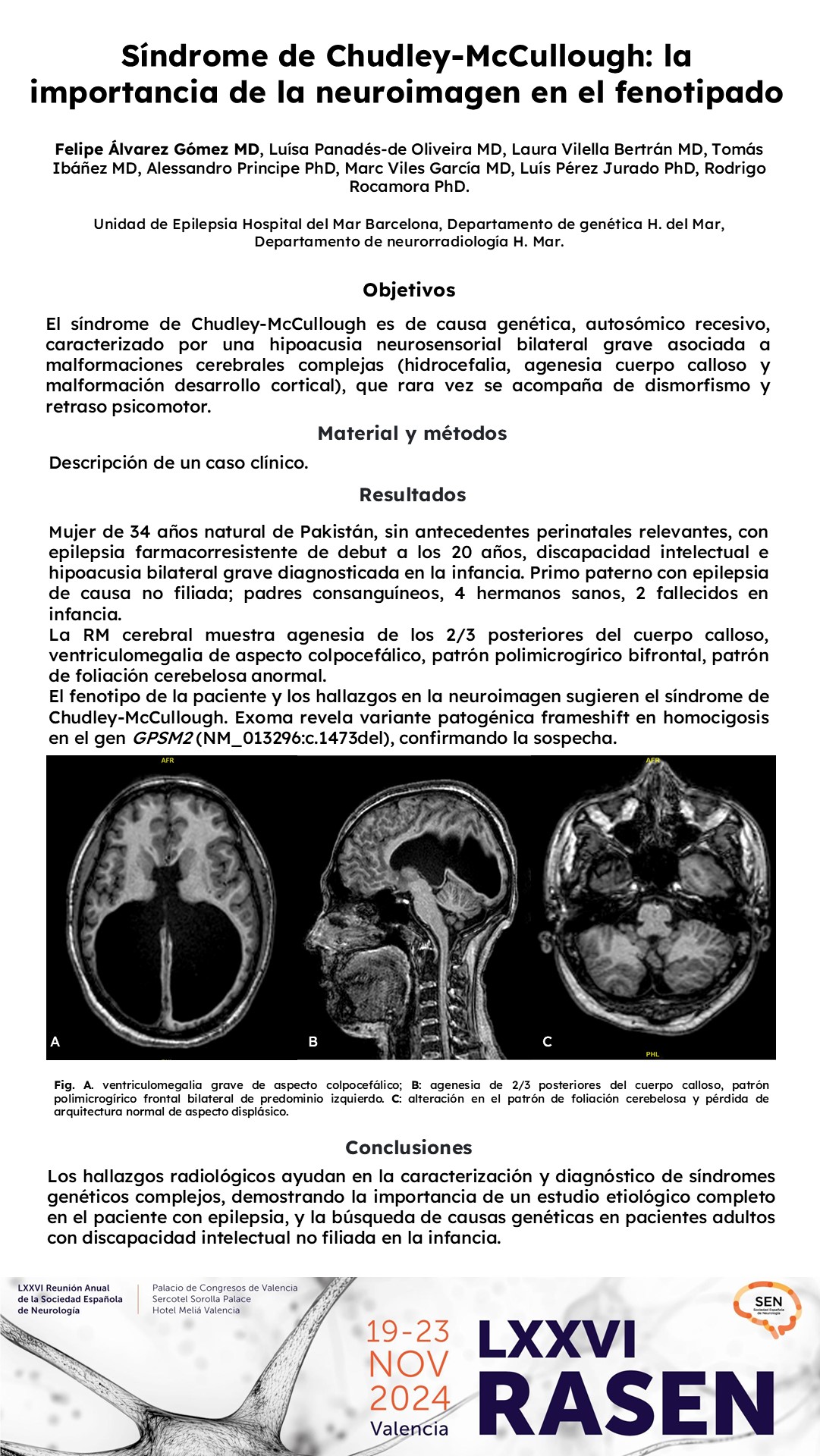 Síndrome de Chudley-McCullough: la importancia de la neuroimagen en el fenotipado