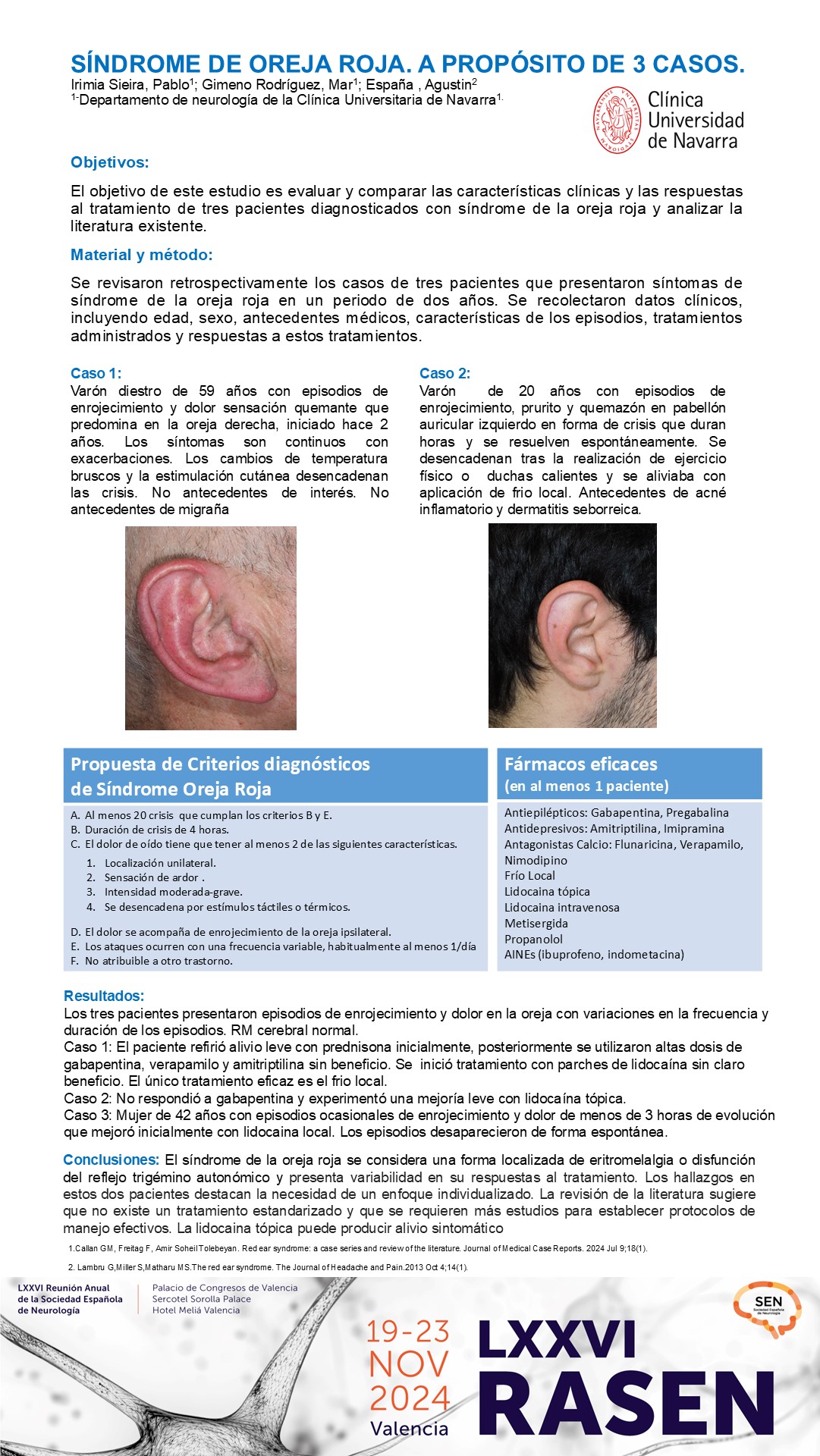 Síndrome de Oreja roja. A propósito de tres casos