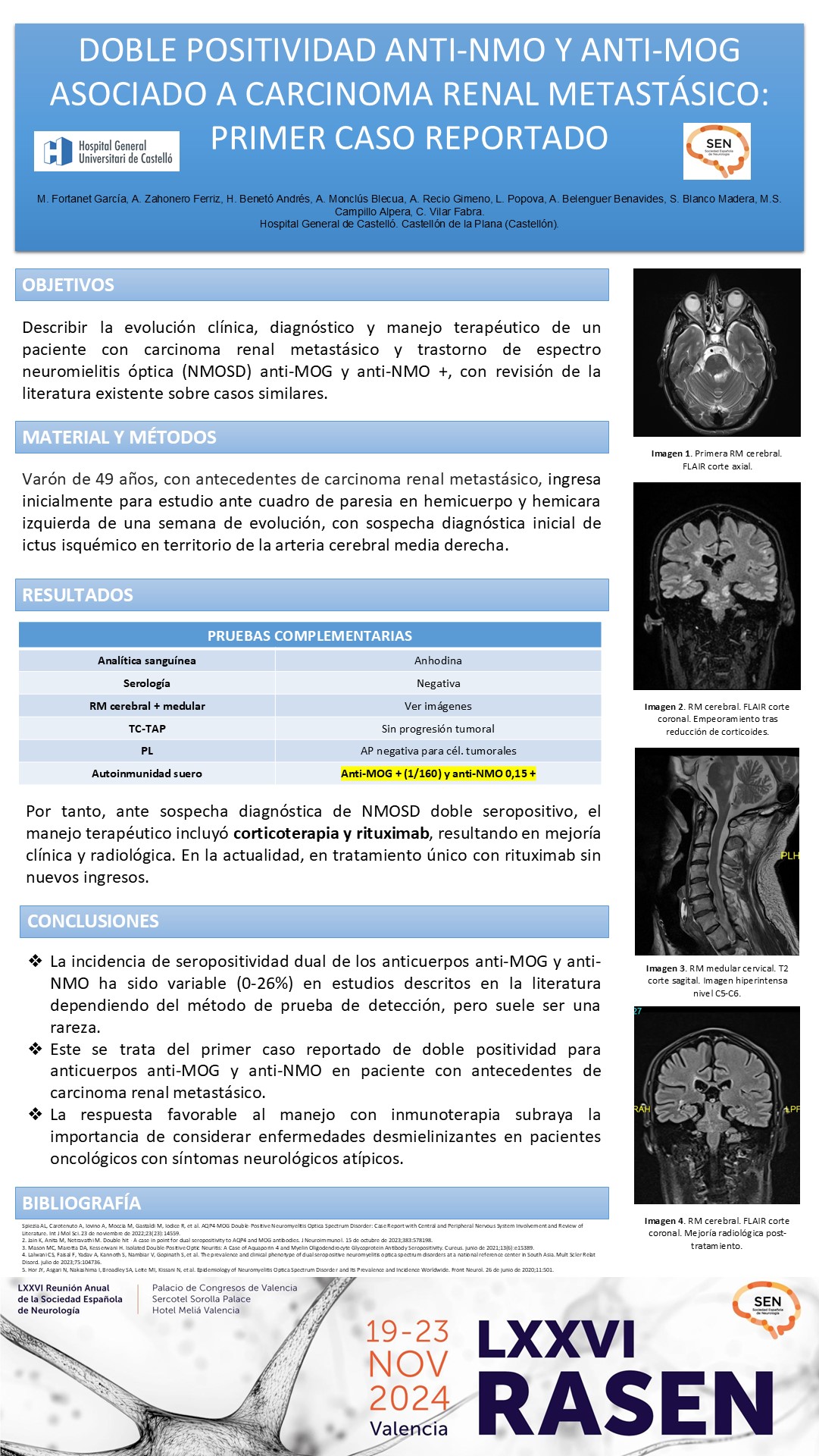 Doble positividad anti-NMO y anti-MOG asociado a carcinoma renal metastásico: primer caso reportado