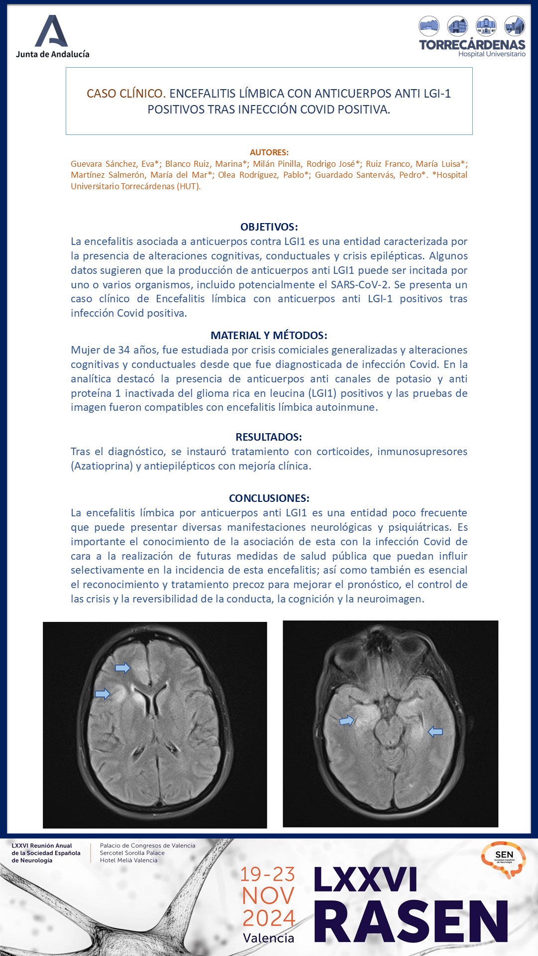 Caso clínico: encefalitis límbica con anticuerpos anti LGI-1 positivos tras infección COVID positiva